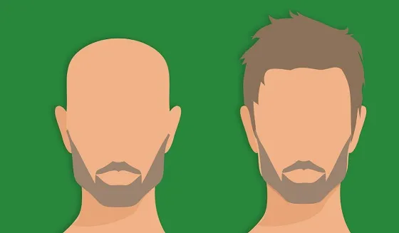 Hair transplants